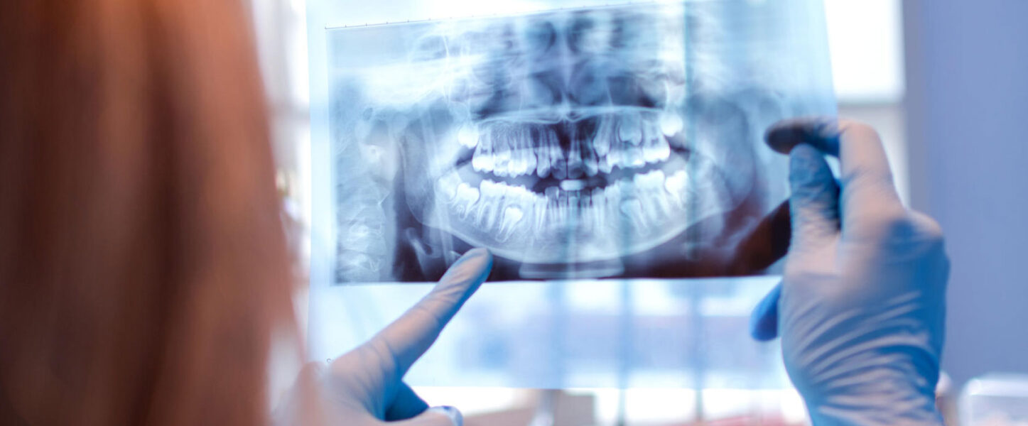 All about X-Rays