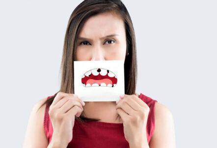 The Beginner's Guide to Dental Cavities: Here's All You Need to Know