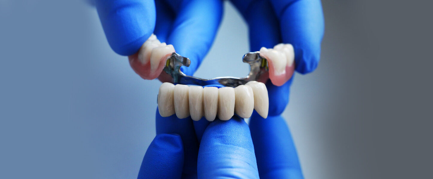 The Beginner’s Guide to Dental Bridges: All You Need to Know