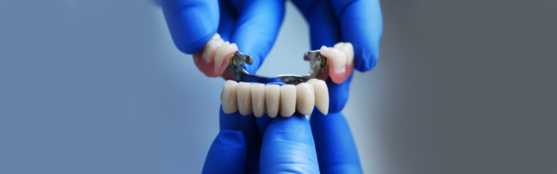 The Beginner’s Guide to Dental Bridges: All You Need to Know