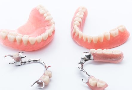 What Are Dentures And Partial Dentures?