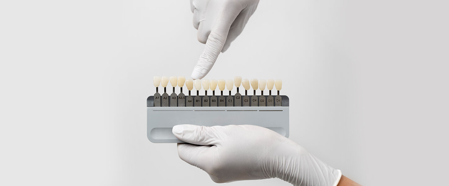 How Dental Veneers Can Fix Common Smile Imperfections