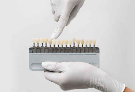 How Dental Veneers Can Fix Common Smile Imperfections