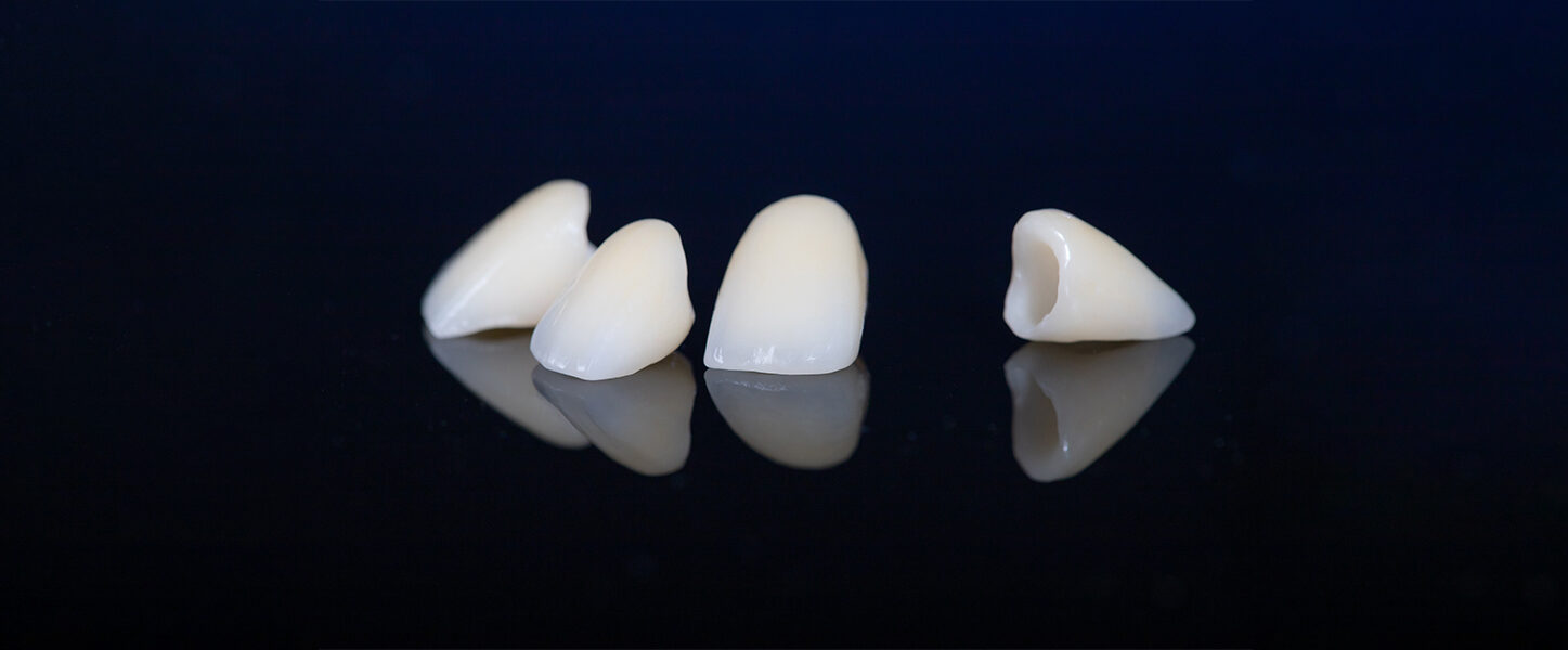 Understanding Dental Crowns