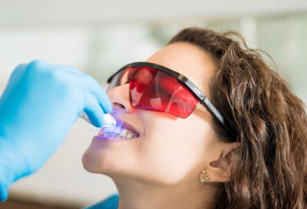ICON vs. Traditional Whitening: Which Is Better for White Spots in Dallas?