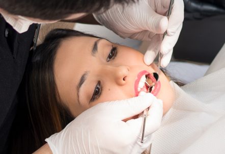 Comprehensive Guide to Root Canal Therapy: Restoring Dental Health