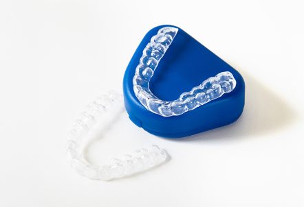 SureSmile® clear aligners in Dallas, TX, SureSmile® clear aligners dentist near me