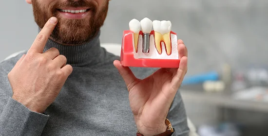Dental Implant Placement